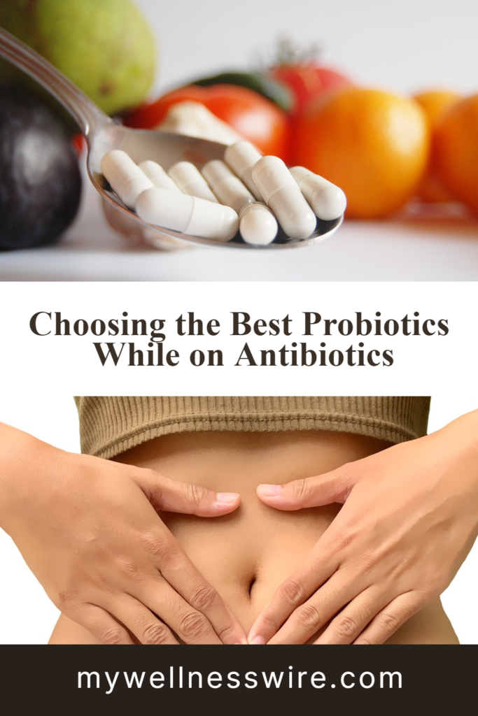 best probiotics while on antibiotics pinterest image
